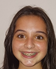 fotografia associado
